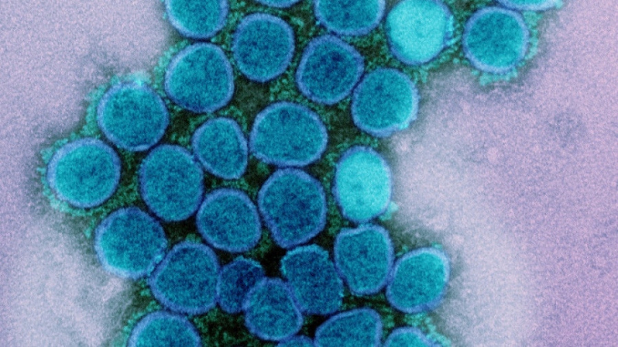 Лекари от цял свят алармират! Тръгна нов изключително заразен вирусен щам