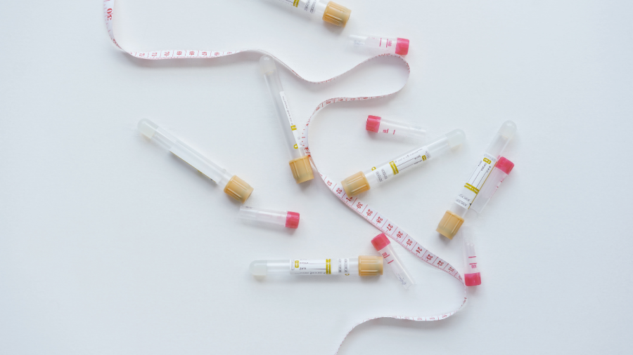 Д-р Васил Бранков: За инвитро процедурите най-важно е спокойствието