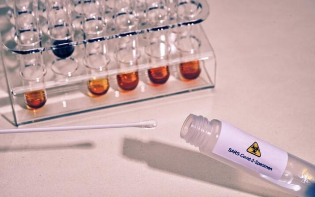 КОВИД-ът настъпва! Всеки седми - с положителен тест за вируса